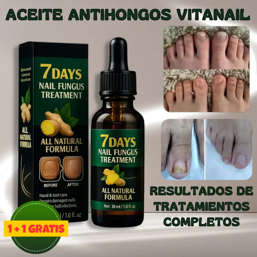 Aceite Vitanail™ - ¡Resultados visibles en solo 7 días!