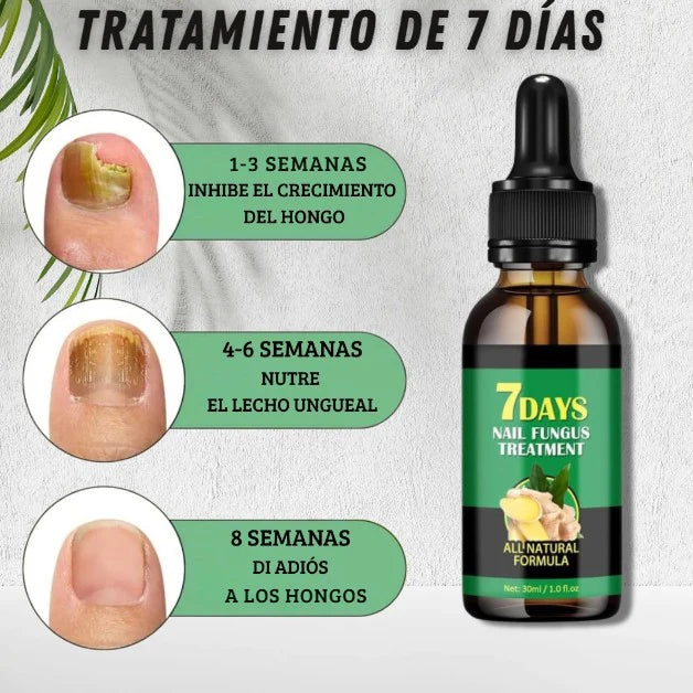 Aceite Vitanail™ - ¡Resultados visibles en solo 7 días!