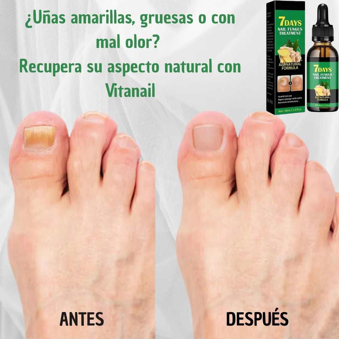 Aceite Vitanail™ - ¡Resultados visibles en solo 7 días!