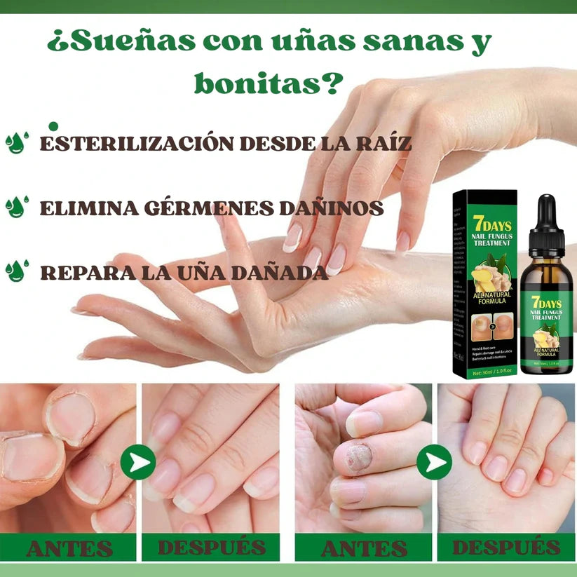 Aceite Vitanail™ - ¡Resultados visibles en solo 7 días!