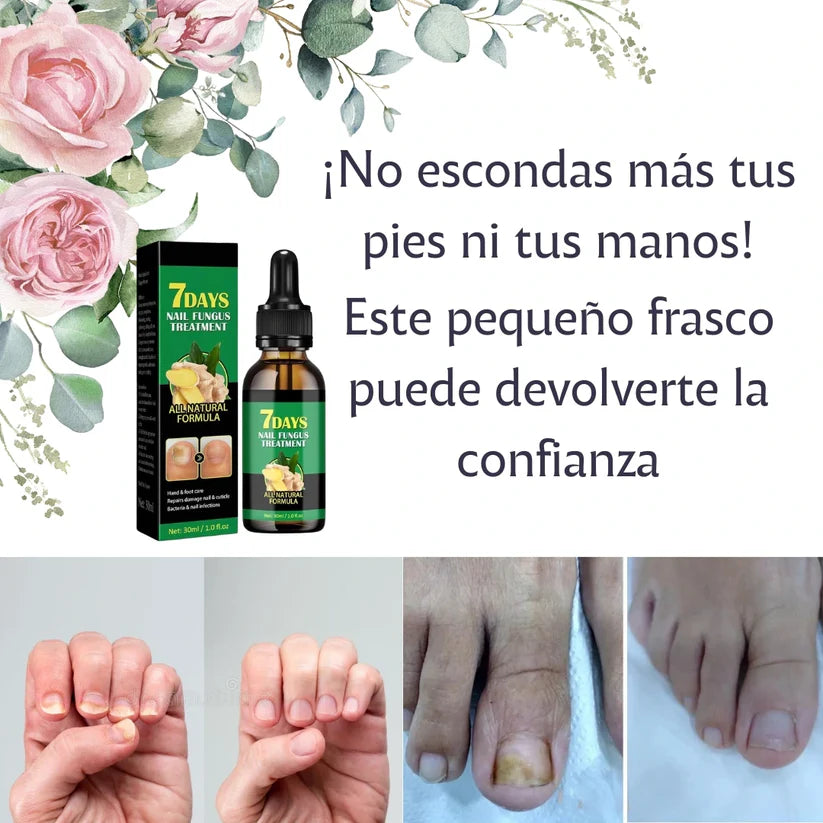 Aceite Vitanail™ - ¡Resultados visibles en solo 7 días!